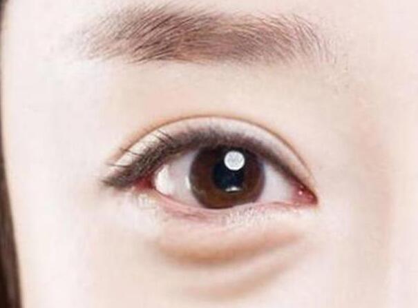 眼袋？淚溝？臥蠶？南寧美容學校教你辨別