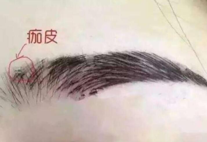 紋眉結(jié)痂時(shí)要注意什么？麗紋竹繡學(xué)校教你