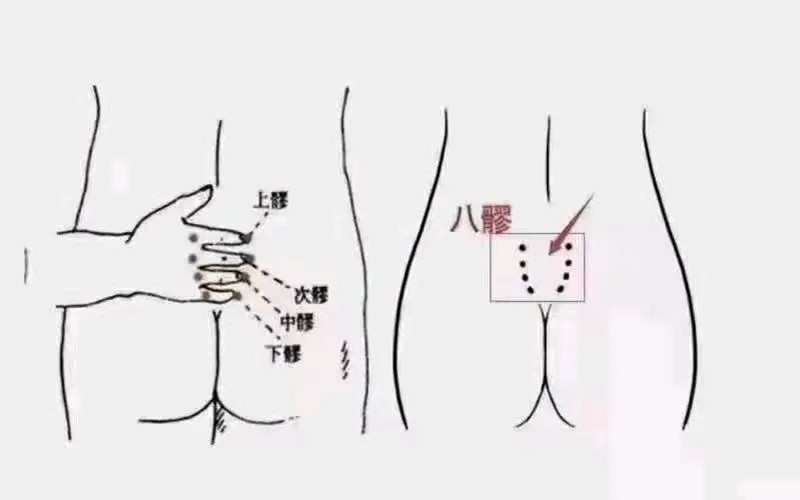 疏通八髎注意事項，南寧中醫(yī)美容學(xué)校培訓(xùn)內(nèi)容