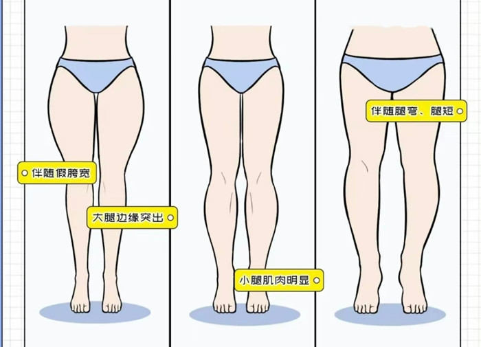 腿粗女生穿搭攻略，廣西彩妝造型搭配