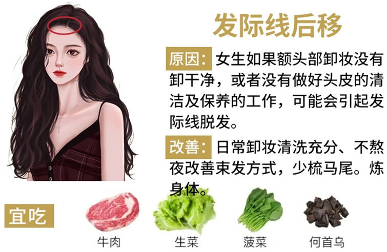如何改善掉頭發(fā)？南寧頭療養(yǎng)發(fā)護發(fā)教學(xué)