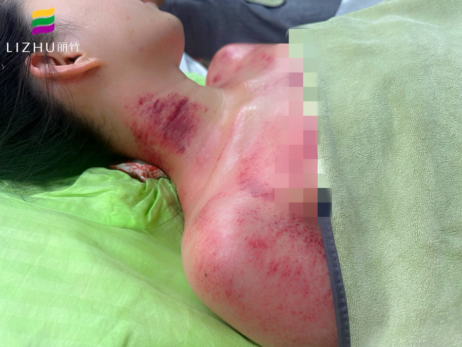 廣西學(xué)刮痧培訓(xùn)班 | 廣西學(xué)刮痧學(xué)費多少？