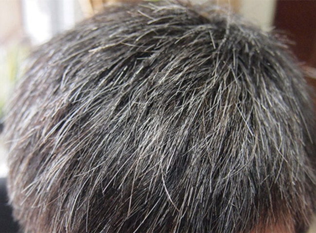 南寧美發(fā)基礎(chǔ)教學(xué)：為什么會(huì)長(zhǎng)白頭發(fā)？