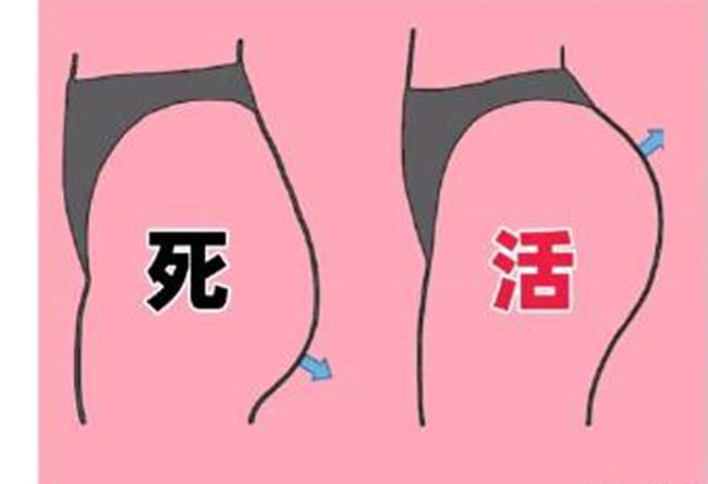 如何改善你臀部的健康情況？南寧美容形象